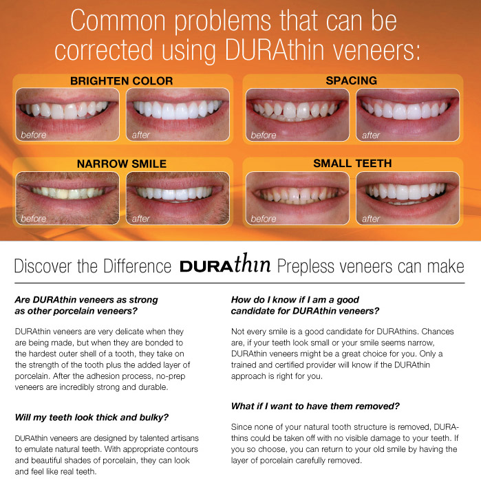 durathin veneers before and after